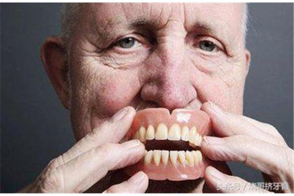 老人拔了牙多久可以鑲牙