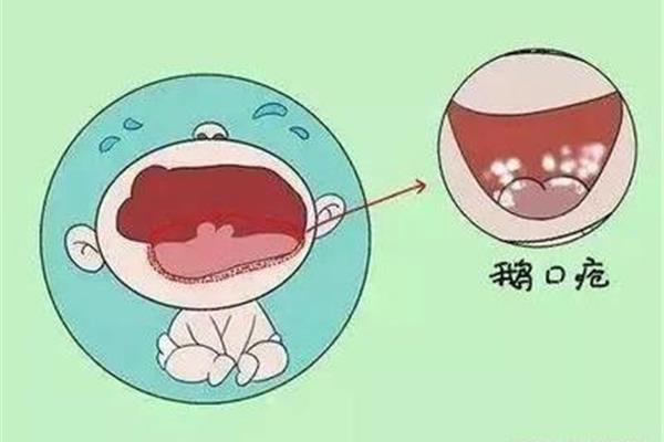 寶寶的出牙期一般持續多久,寶寶出牙的常見情況?
