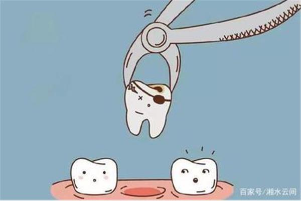 拔牙后多長時間插齒最好?拔牙后多久可以補牙?