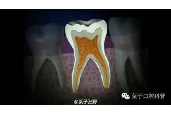兒童乳牙根管治療能用多久