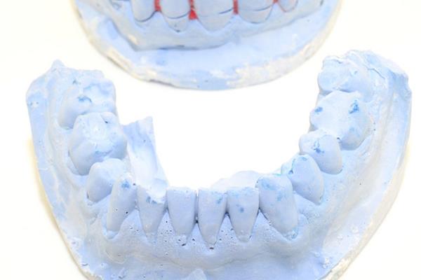 一個完整的牙模可以保存多久,一個牙模可以保存多久?