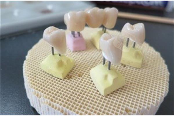 多久用一次牙線比較好?牙膏里有什么成分可以美白?