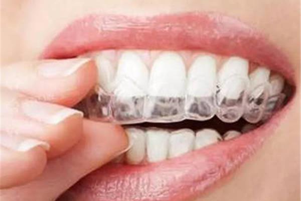 做隱形矯正需要多久,矯正牙齒需要多久?