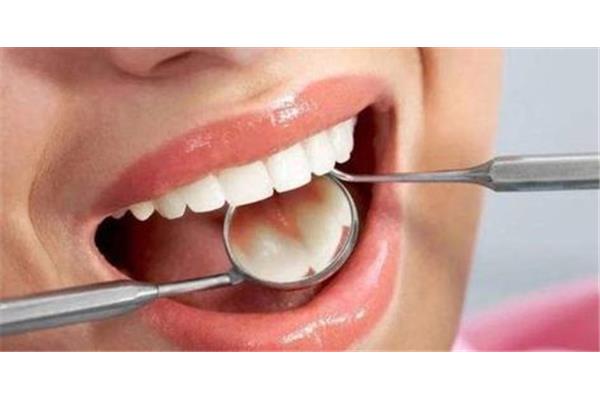 補牙一般要多久,樹脂補牙能補多久?