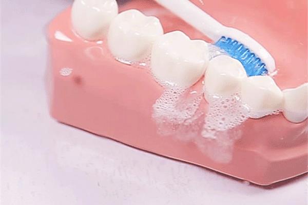 刷多久的牙可以去除牙菌斑