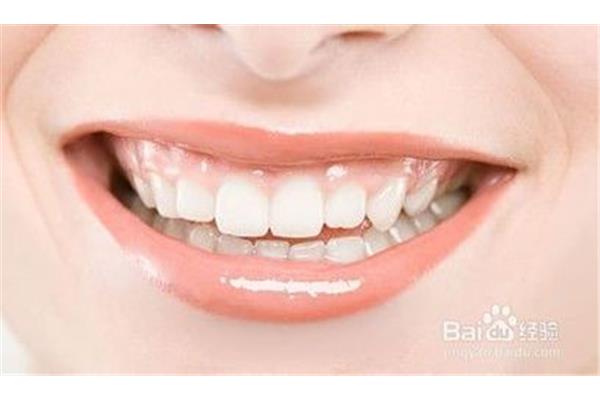 斷牙可以補牙,補牙有斷牙和蛀牙