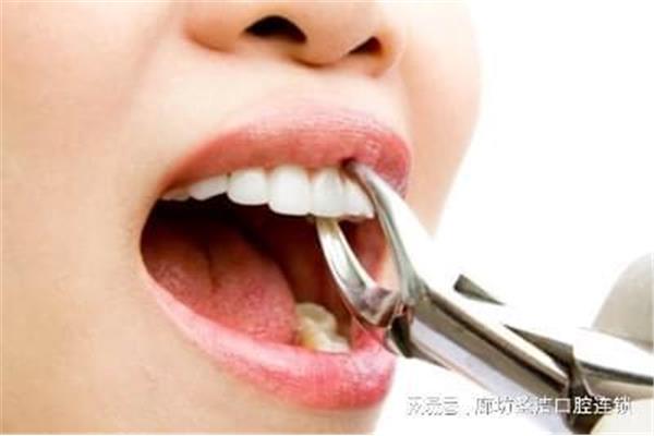 拔牙后多久可以咀嚼,智齒拔除后可以正常進食?
