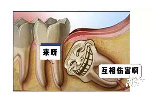 智齒拔掉后能在那里吃多久,智齒拔掉后蛀牙能長多久?