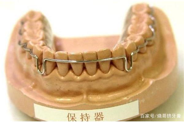 摘掉牙套后多久戴一次保持器,保持器多少錢?