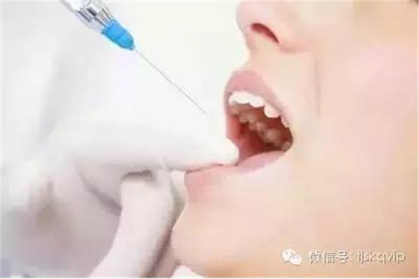 拔牙術后疼多久能恢復正常