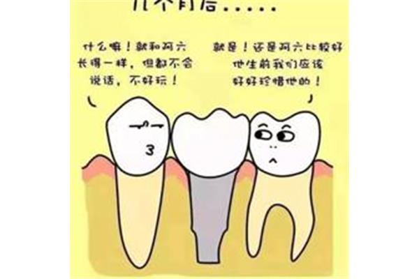 假牙要裝多久
