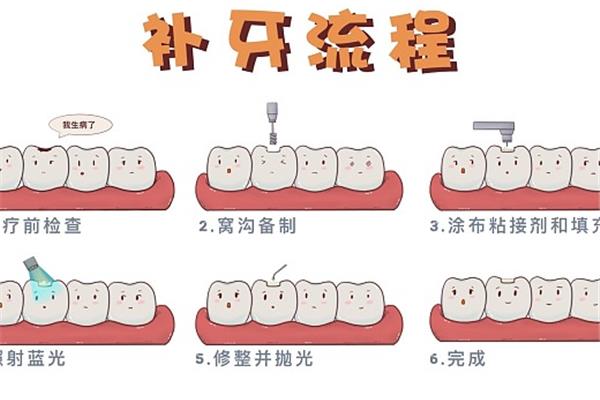 牙齒補牙后能用多久