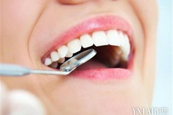 補牙需要多長時間,門牙不補會有什么影響?