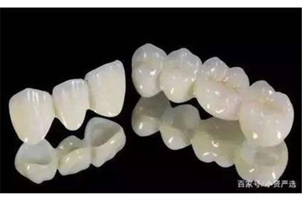 一顆超級水晶瓷氧化鋯牙多少錢?國產氧化鋯烤瓷牙排名