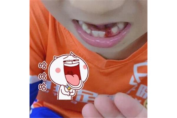 拔完乳牙能正常吃多久,孩子拔完乳牙能正常吃多久?