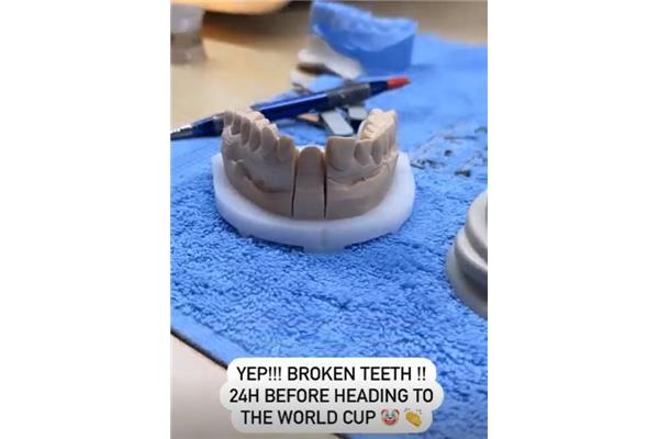 斷了的牙齒多久能恢復嗎
