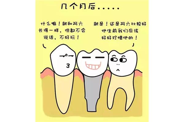 什么是種植牙?要多久才能長好?種植牙植骨后需要幾天才能長好?
