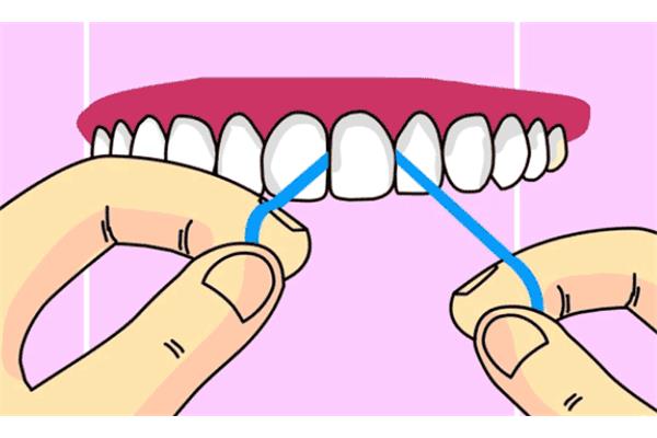種植牙前多久洗牙合適,多久洗牙一次合適?
