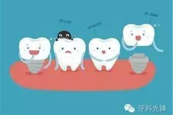 涂氟后多久可以洗牙?洗牙后可以涂氟化物嗎?