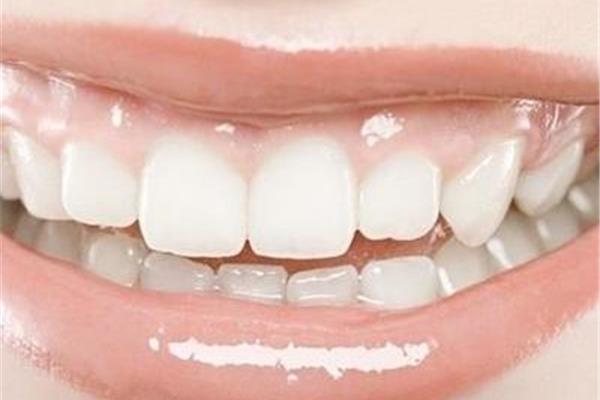 學會牙齒固定需要多久,牙齒固定需要多久?