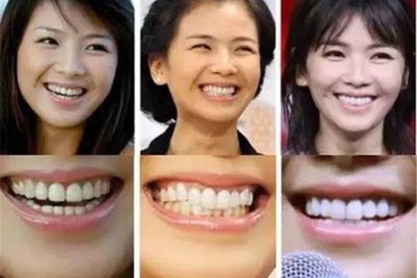矯正牙齒需要多長時間?牙齒長的不規則怎么辦??