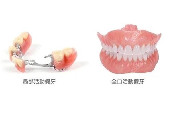 长期戴固定义齿会得牙龈癌吗(长期戴固定义齿的危害)