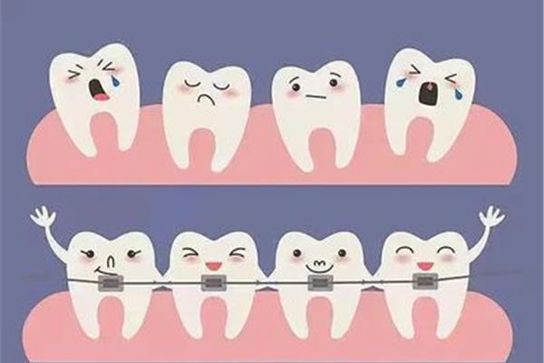 箍牙要多久才能排齊,牙齒要排齊多久?