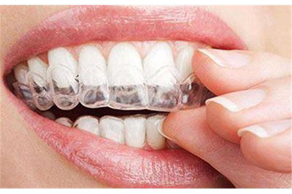 矯正牙齒后多久可以吃硬東西,成年人矯正牙齒需要多久?