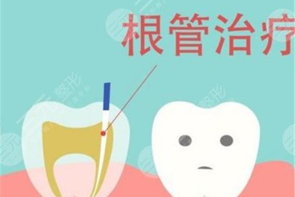 牙齿根管治疗需要多长时间(牙齿根管治疗需要多长时间)