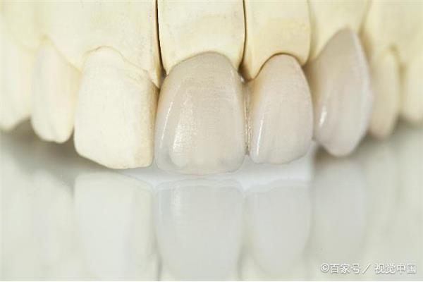 全瓷牙齒修復,真實記錄全瓷牙齒修復全過程!