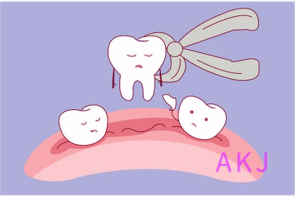 拔牙后牙齿出血需要多长时间恢复(智齿拔除后需要多长时间完全止血)