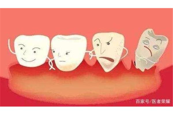 換牙牙齦腫