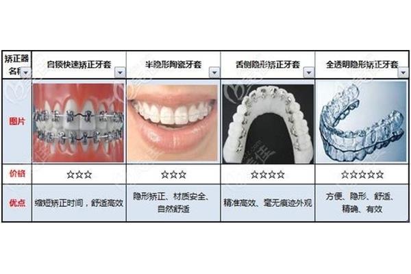牙齒矯正方式