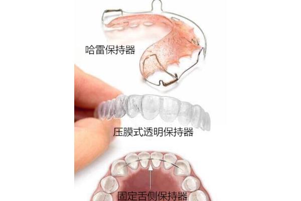 一對透明固位體可以用多久?關于透明牙套固定器
