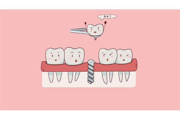 缺牙如何矯正牙齒(缺牙矯正牙齒的全過程)