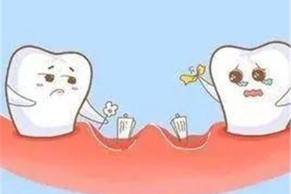 先天性缺牙如何矯正(缺一顆牙可以矯正并一起拔嗎?)