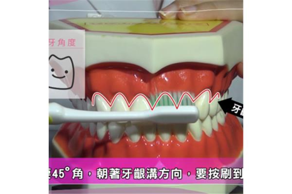 牙齒矯正要多少錢(牙齒矯正一般要多少錢?)