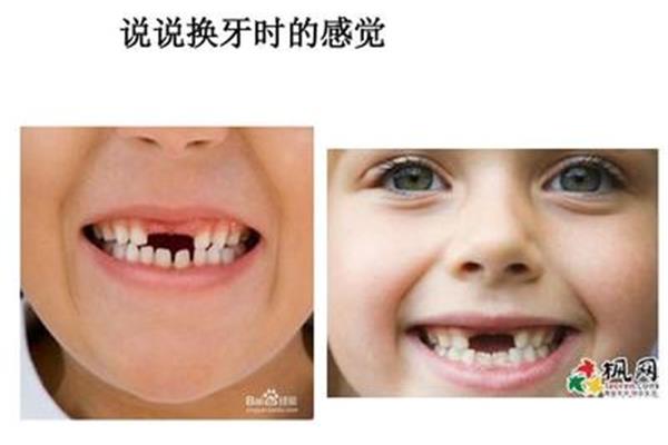孩子換牙是在中班還是at 大班換牙(為什么幼兒園的班級會掉牙?)