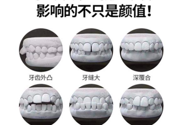 廈門隱適美牙齒矯正的程序是怎樣的(隱形牙齒矯正的矯正效果如何?)
