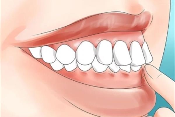 牙齦萎縮的原因(最可怕的是牙齦萎縮)