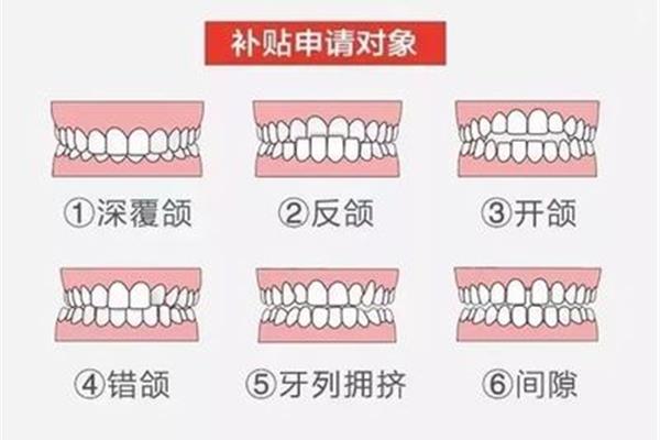 牙齒為什么會咬嘴唇?(為什么咬牙?)