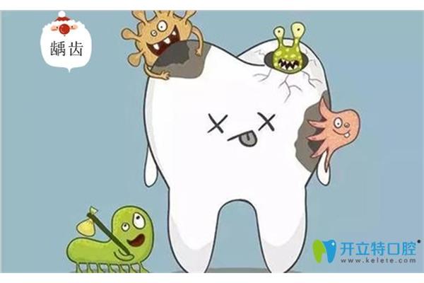 兒童臼齒換牙