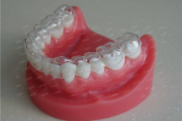 矯正牙齒的方法有哪些(矯正牙齒的過程是怎樣的?)