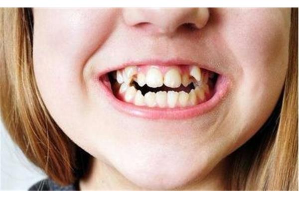 兒童牙齒問題