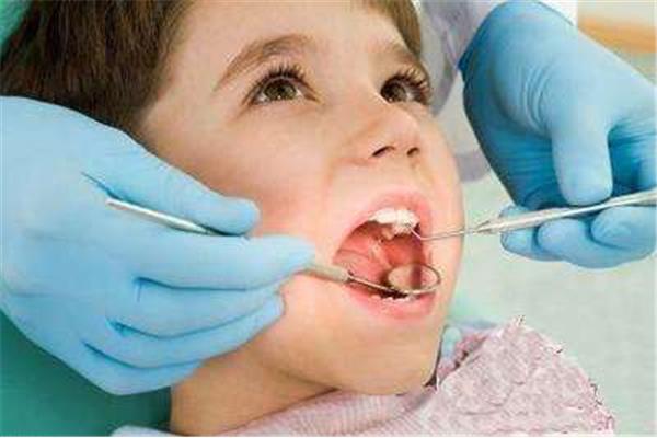 牙弓擴張器兒童牙齒矯正
