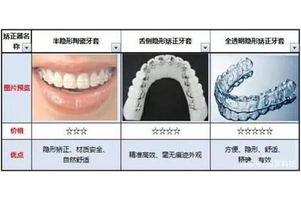 牙齒透明矯正器價格(牙齒透明矯正器)