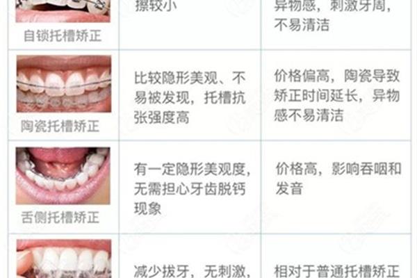 醫院<a href=https://www.nkjjw.org/jiaozhengyachi target=_blank class=infotextkey>矯正牙齒</a>費用