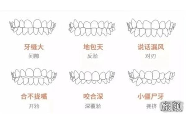 牙齒之間的縫隙可以矯正嗎(如何矯正門牙之間的縫隙)