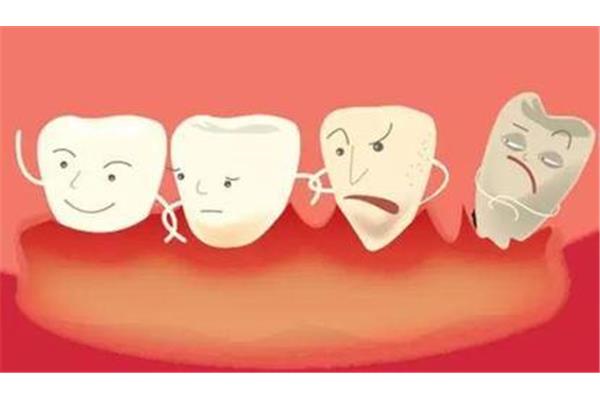 有牙周病可以矯正牙齒嗎?(正畸的禁忌癥!先看后改!)