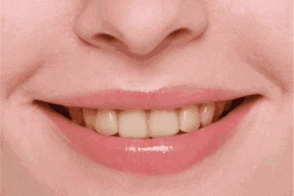 牙齒齙牙有什么危害(牙齦突出怎么辦?)